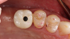footer_image